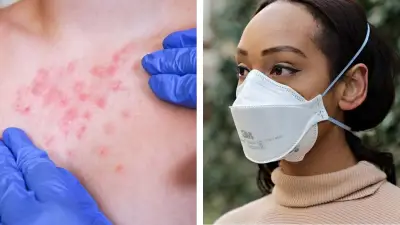 Brote de Sarampión: Estados Recomiendan Cubrebocas, pero Expertos Cuestionan su Eficacia