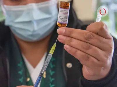 Dosis Cero de Sarampión en México: Todo lo que Debes Saber para 2026