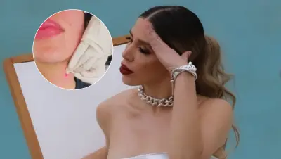 Emma Coronel revela su tratamiento Endolift para reducir la papada en video viral