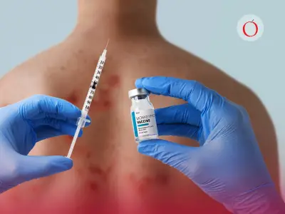 OMS alerta: desinformación sobre vacunas provoca regreso del sarampión en Europa