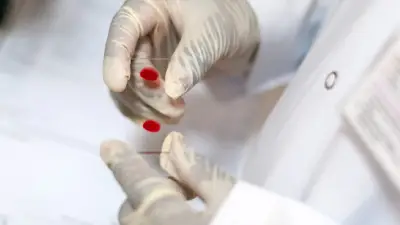 Pruebas gratuitas de VIH, hepatitis C y sífilis en CDMX: sin cita y confidenciales