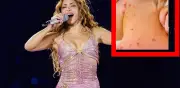 Autoridades descartan riesgo de sarampión en concierto de Shakira en Zócalo CDMX