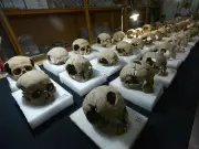 Científicos rusos descubren cirugía maxilofacial de 2.500 años en cráneo de mujer pazyryk