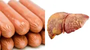 Hígado graso: el riesgo oculto de los embutidos como salchicha, jamón y chorizo