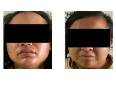 Condenan a 37 años a padrastro por feminicidio y abuso de niña de 2 años en Jalisco