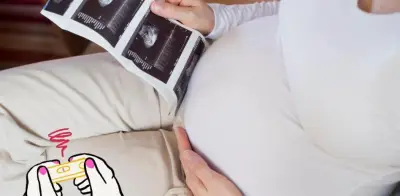 Embarazo Psicológico: El Trastorno que Genera Síntomas de Gestación sin Feto