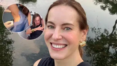 Gaby Platas revela sus tratamientos estéticos: desde bótox hasta procedimientos en axilas