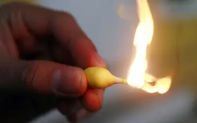 IMSS advierte: remedios caseros como mostaza agravan quemaduras y ponen en riesgo la vida