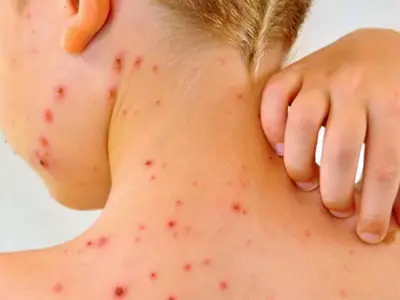 San Luis Potosí reporta nuevo caso de Covid-19 en adulta mayor sin vacunar