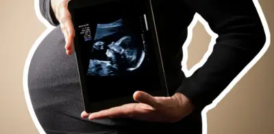 Vacuna VSR en elembarazo: Semana clave para proteger al bebé desde la gestación