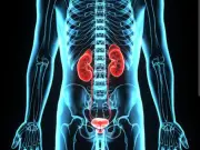 Cáncer de Vejiga y Riñón: Sangre en Orina es Señal de Alerta que No Debe Ignorarse