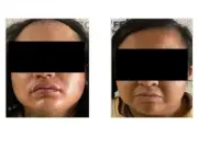 Condenan a 37 años a padrastro por feminicidio y abuso de niña de 2 años en Jalisco