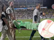 Malagón sufre grave ruptura de tendón de Aquiles: lesión que amenaza su temporada