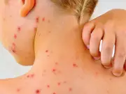 San Luis Potosí reporta nuevo caso de Covid-19 en adulta mayor sin vacunar