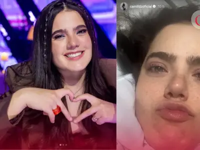 Camila Fernández es operada de emergencia por apendicitis tras reunión con Río Roma
