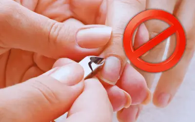 Cortar las cutículas: un riesgo para la salud de tus uñas y piel