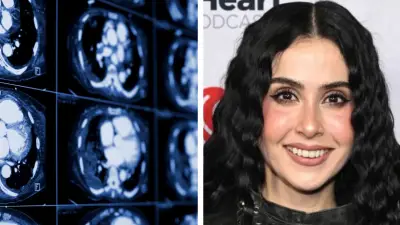 Hematoma Subdural: Diagnóstico que alejó a Lupita Villalobos de Supernova Génesis