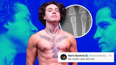 Mario Bautista sufre fractura en mano tras pelea en Supernova Génesis