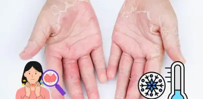 Piel seca persistente: ¿Cuándo es señal de una enfermedad subyacente?