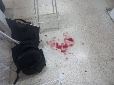 Alumno apuñala a maestro en secundaria de Huimanguillo, Tabasco; grave