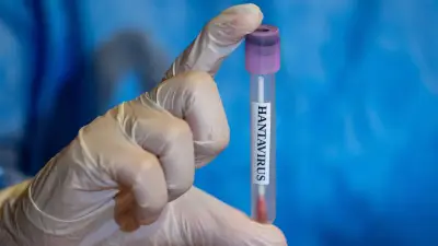 Brote de hantavirus: ¿cuánto tardan en aparecer los primeros síntomas?