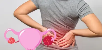 Dolor lumbar persistente: señal de alerta de cáncer de ovario