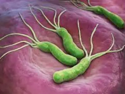 Helicobacter pylori: 7 de cada 10 mexicanos podrían tener la bacteria
