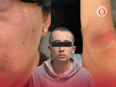 Nueva agresión en CCH Sur enciende alarmas de seguridad