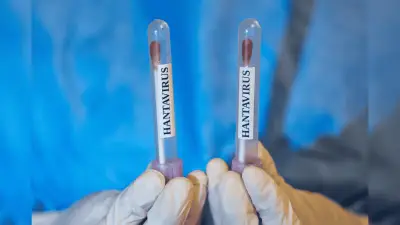 OMS descarta riesgo alto por hantavirus: no es un nuevo Covid