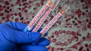 Alerta epidemiológica por hantavirus: síntomas iniciales similares a gripe