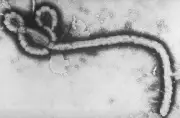 Alerta sanitaria por Ébola en África: primeros síntomas y prevención