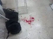 Alumno apuñala a maestro en secundaria de Huimanguillo, Tabasco; grave