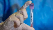 Brote de hantavirus: ¿cuánto tardan en aparecer los primeros síntomas?