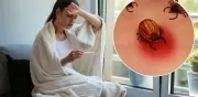 Enfermedad de Lyme: por qué se confunde con lupus y fibromialgia