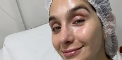 Marcela Mistral se somete a cirugía de implantes tras 17 años