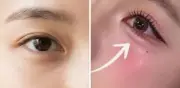Aegyo sal: la técnica coreana infalible para rejuvenecer tu mirada