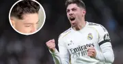 Federico Valverde muestra por primera vez la cicatriz del incidente con Tchouaméni
