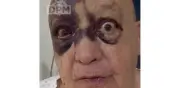 Luis de Alba 'El Pirruris' sufre accidente y preocupa a sus fans