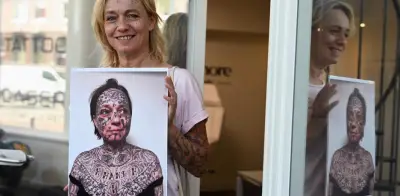 Borran tatuajes de violencia de género: fundación neerlandesa ofrece tratamiento gratuito