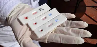 OMS alerta: VIH, hepatitis e ITS causan 2.3 millones de muertes al año