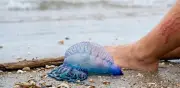 Agua malas en el mar: riesgos, prevención y qué hacer ante una picadura