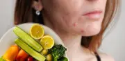 Dieta y acné hormonal: alimentos clave para cuidar la piel